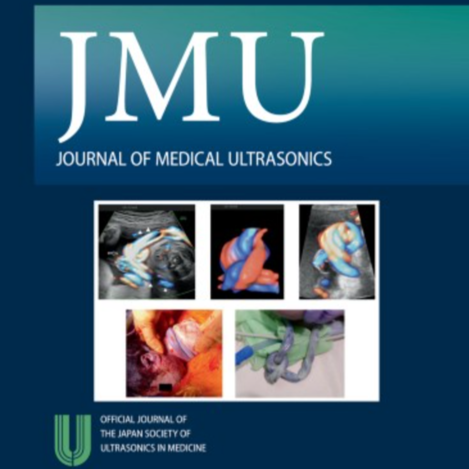 瀧田寛子講師の論文がJournal of Medical UltrasonicsのEditor's Choiceとして紹介されました。